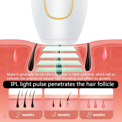 Épilateur IPL Lumière Pulsée — 999 999 Flashs